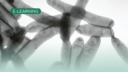 eLearning, Legionella bacteria.jpg